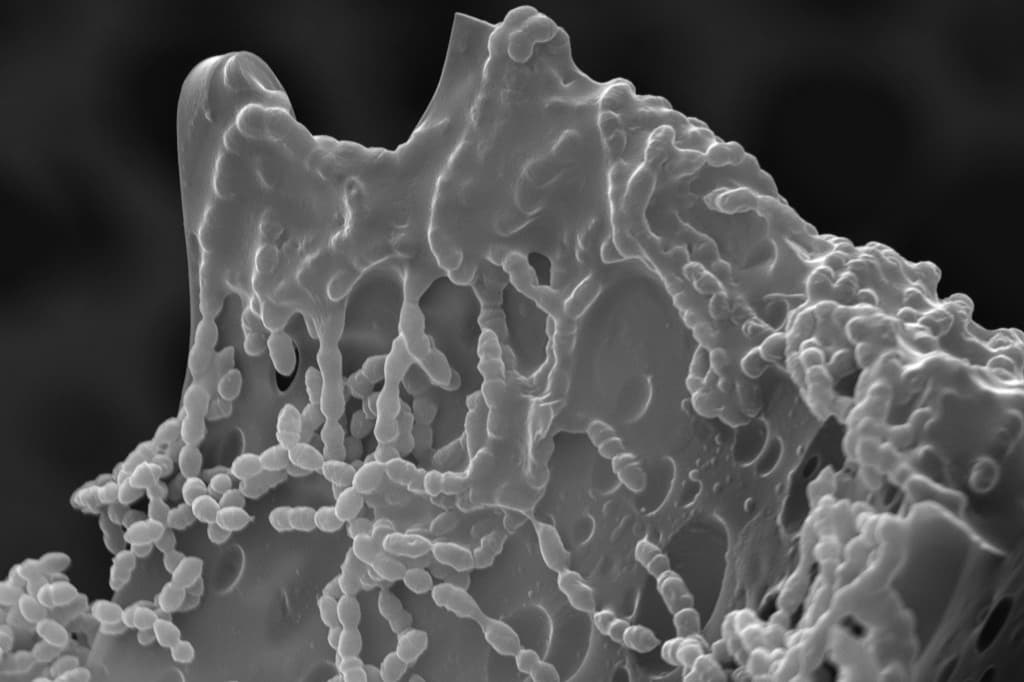 Biofilm buildup inside dental waterlines